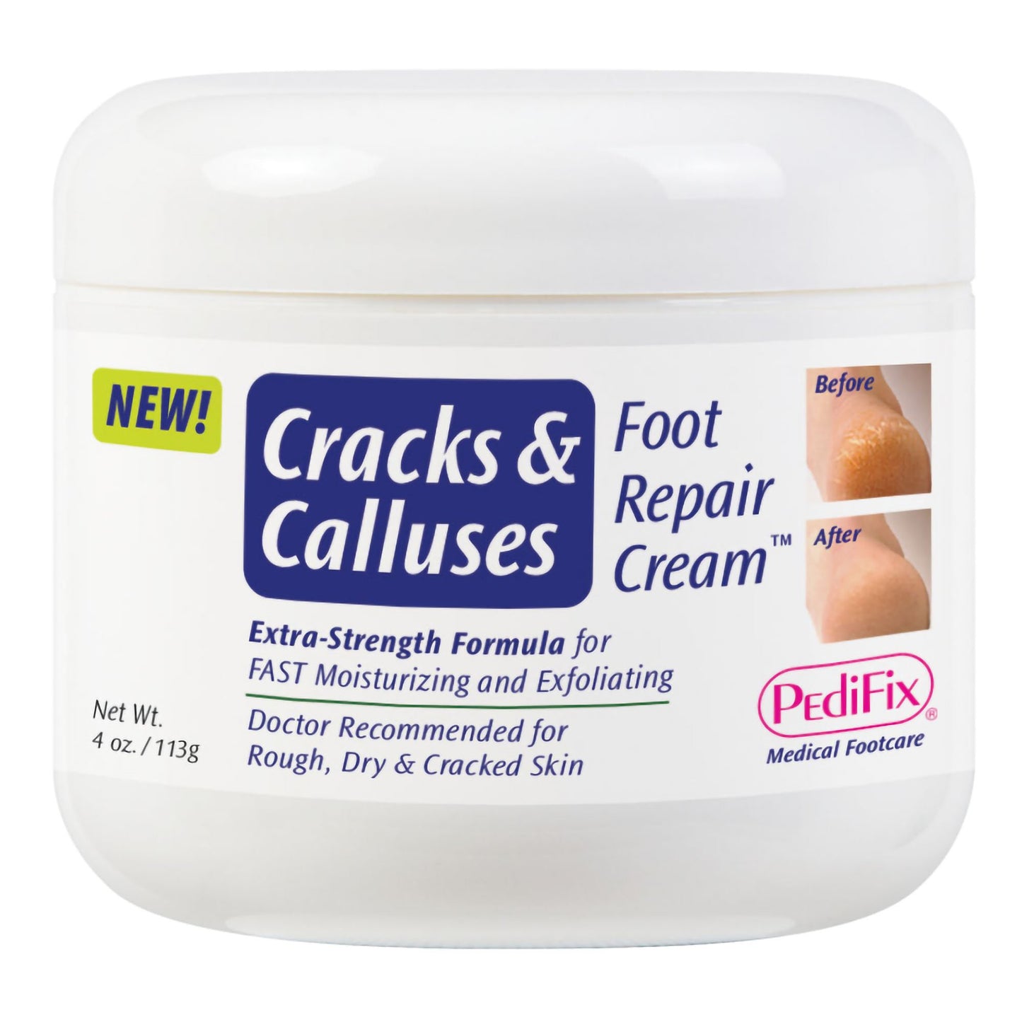 PediFix Cracks and Calluses Foot Repair Cream™, 4-ounce Jar