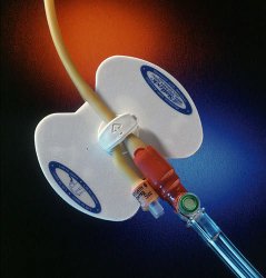 Statlock Stabilization Device
