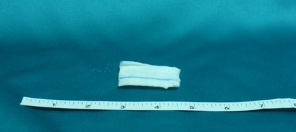 Gauze Sponge Bioseal 2 X 2 Inch 12-Ply Sterile X-Ray Detectable 10 per Pack
