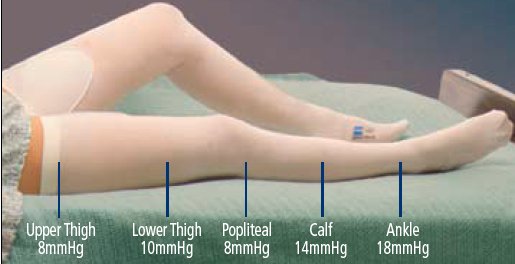 T.E.D.™ Thigh High Anti-embolism Stockings, 2X-Large / Short