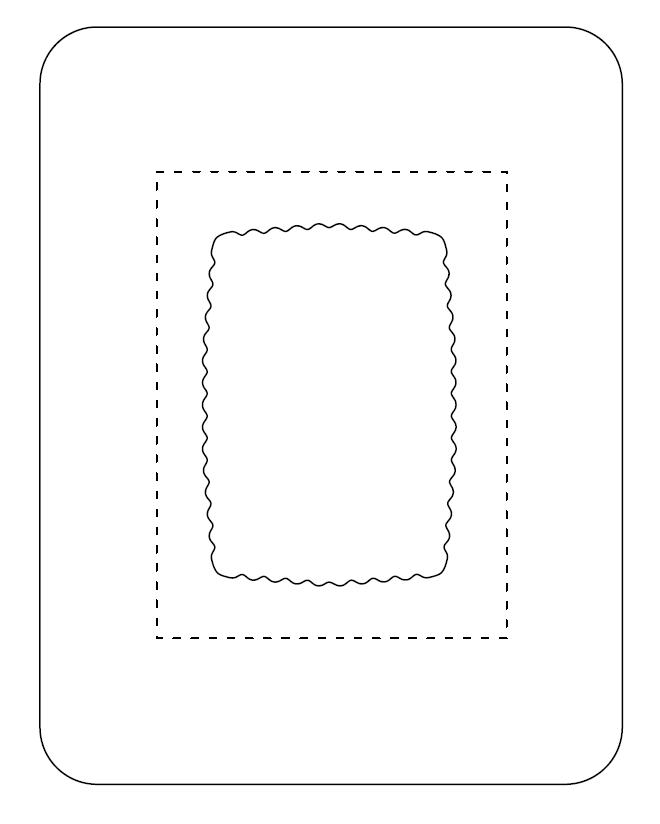 SorbaView 2000 Transparent Film Dressing with Pad