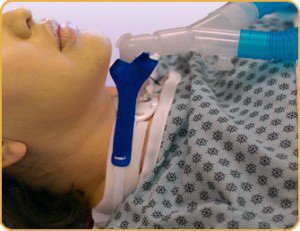 Vent Circuit Anti-Disconnect Device For Trach Ties Tracheostomy Tube